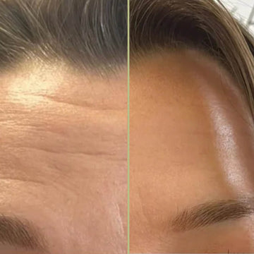 Ageless Medical Clinic before and after treatments