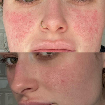 Ageless Medical skin treatment