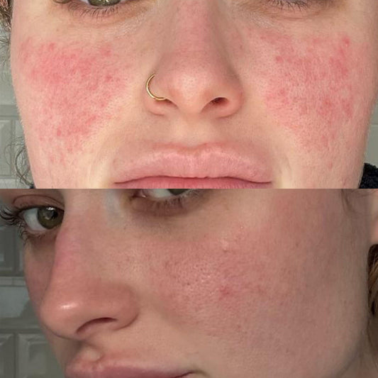 Ageless Medical skin treatment