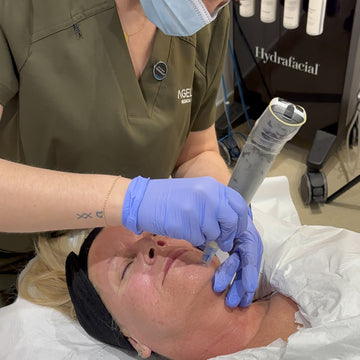 Person receiving a facial treatment with a Hydrafacial device in a clinical setting.