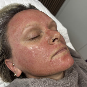 Person lying down with a towel over their head, possibly receiving a facial treatment.