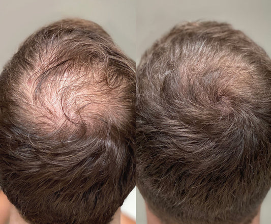 H&B - Hair Growth Package