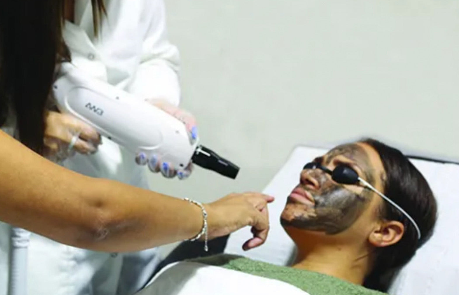 Laser Carbon Facial | Hollywood Peel | Skin Brightening & Pore