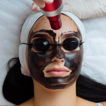Woman receiving a facial treatment with a black mask and laser device.