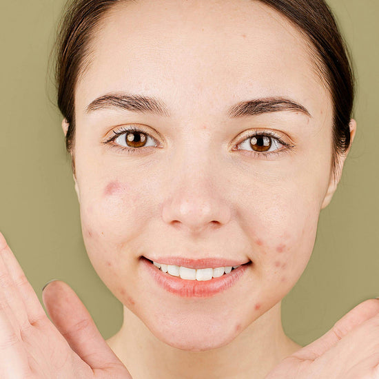 Woman applying cream to her face with a green background